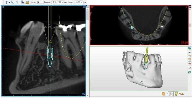 dental-ct-view-image3