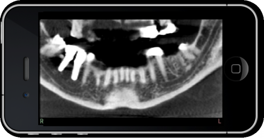 dental-ct-view-image5