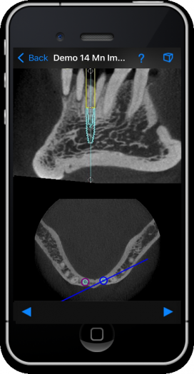 dental-ct-view-image6a