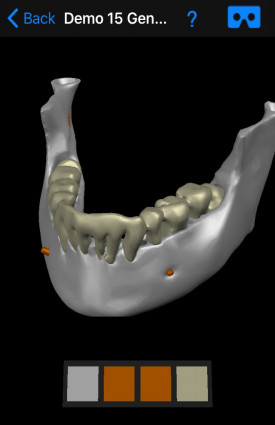 dental-ct-view-image7b
