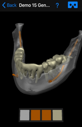 dental-ct-view-image7c